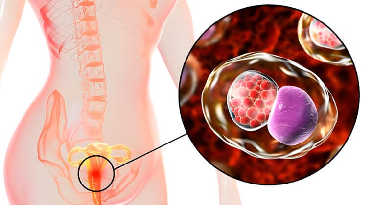 Infecciones de transmisión sexual