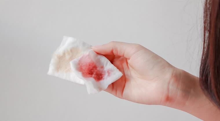 Sangrado vaginal anormal